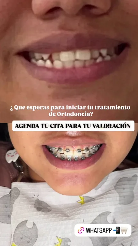 Dental Ruiz | Nuevo Chimbote