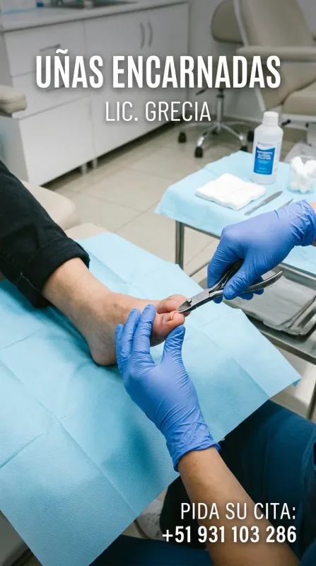 Licenciada Grecia: podología y enfermería a domicilio en Chimbote, Nuevo Chimbote, Santa y Coishco (WhatsApp 931 103 286)
