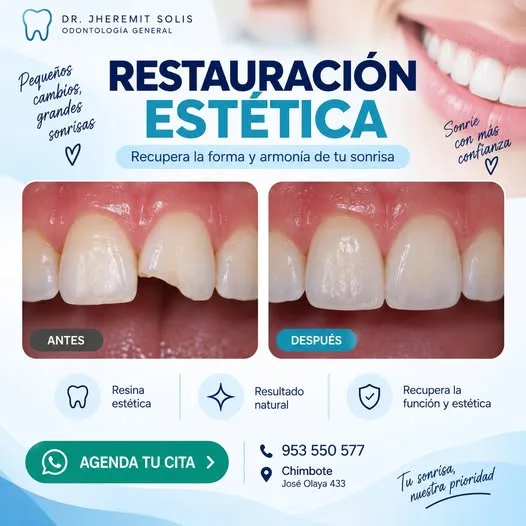 Dr. Jheremit Solis - Odontología General